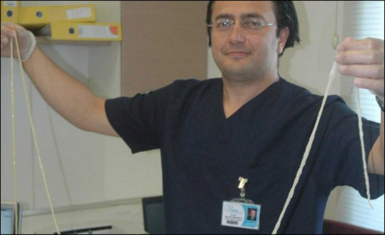 بالصور.. اطباء يستخرجون دودة طولها 2.5 متر من امعاء مريض!!