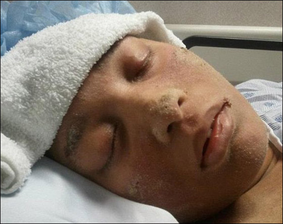 حالة غريبة لشابة ينمو على جسمها أظافر بدلا من الشعر!