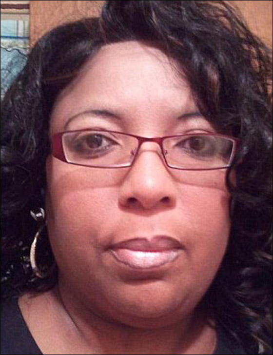 حالة غريبة لشابة ينمو على جسمها أظافر بدلا من الشعر!