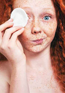 نقدم وصفات خاصة  لمعالجة النمش!