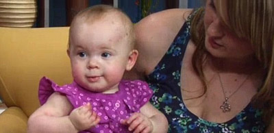 حالة نادرة تترك طفلة من دون جلد على أرجلها مدى حياتها!