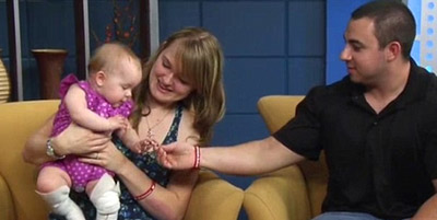 حالة نادرة تترك طفلة من دون جلد على أرجلها مدى حياتها!