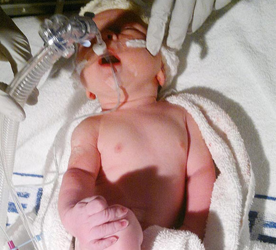 طفلة تتحدى كل الصعاب بعد نمو قلبها في الجهة اليمنى من صدرها!